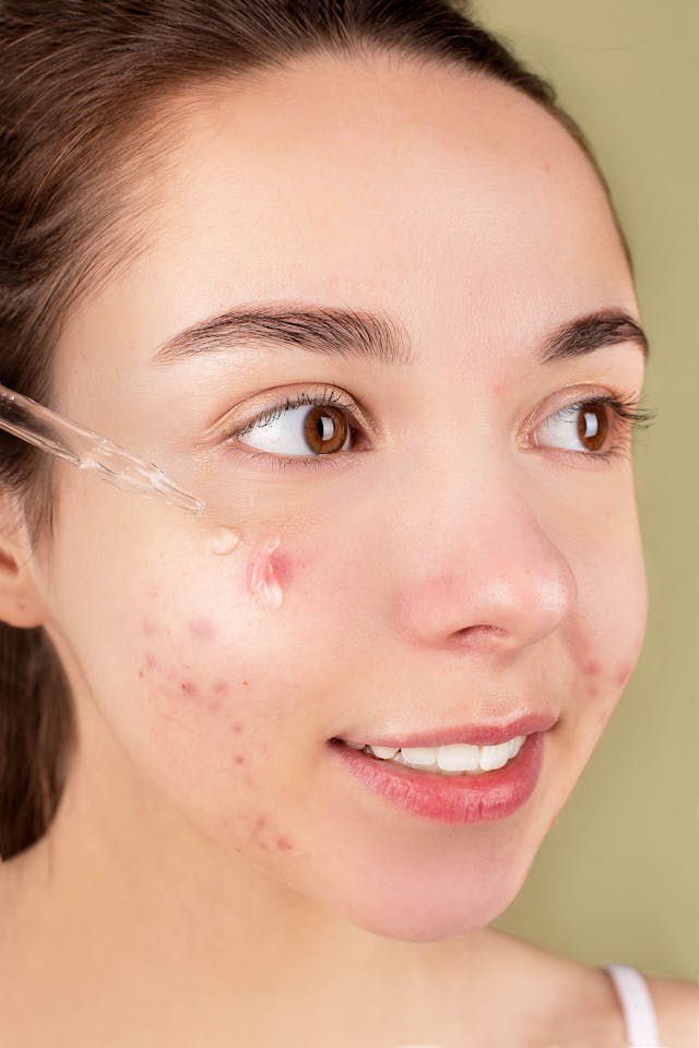 global salicylic acid market